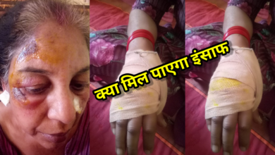 पुलिस सोती रही और खुलेआम वर्ध महिला पर होता रहा अत्याचार कई घण्टे बंधक बनाकर लूट और जान से मारने की कोशिश की गई 