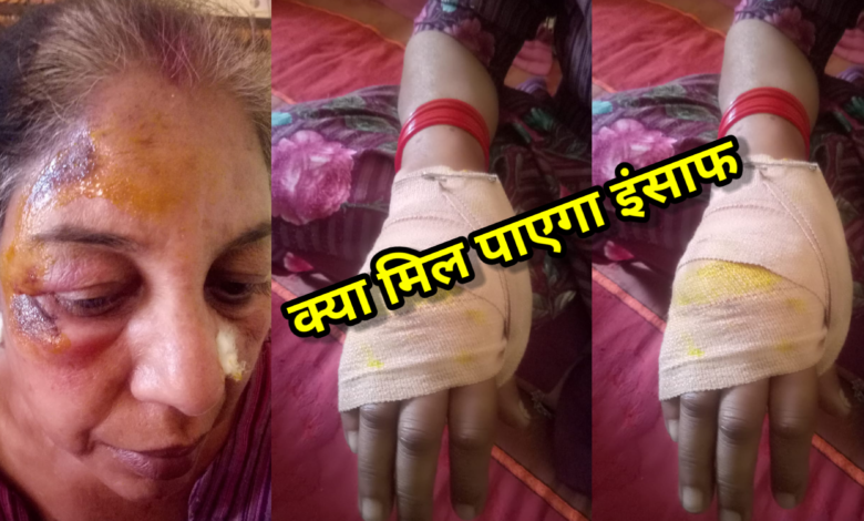 पुलिस सोती रही और खुलेआम वर्ध महिला पर होता रहा अत्याचार कई घण्टे बंधक बनाकर लूट और जान से मारने की कोशिश की गई पुलिस सोती रही और खुलेआम वर्ध महिला पर होता रहा अत्याचार कई घण्टे बंधक बनाकर लूट और जान से मारने की कोशिश की गई